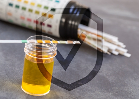 Zapobieganie tworzenia kamieni moczowych